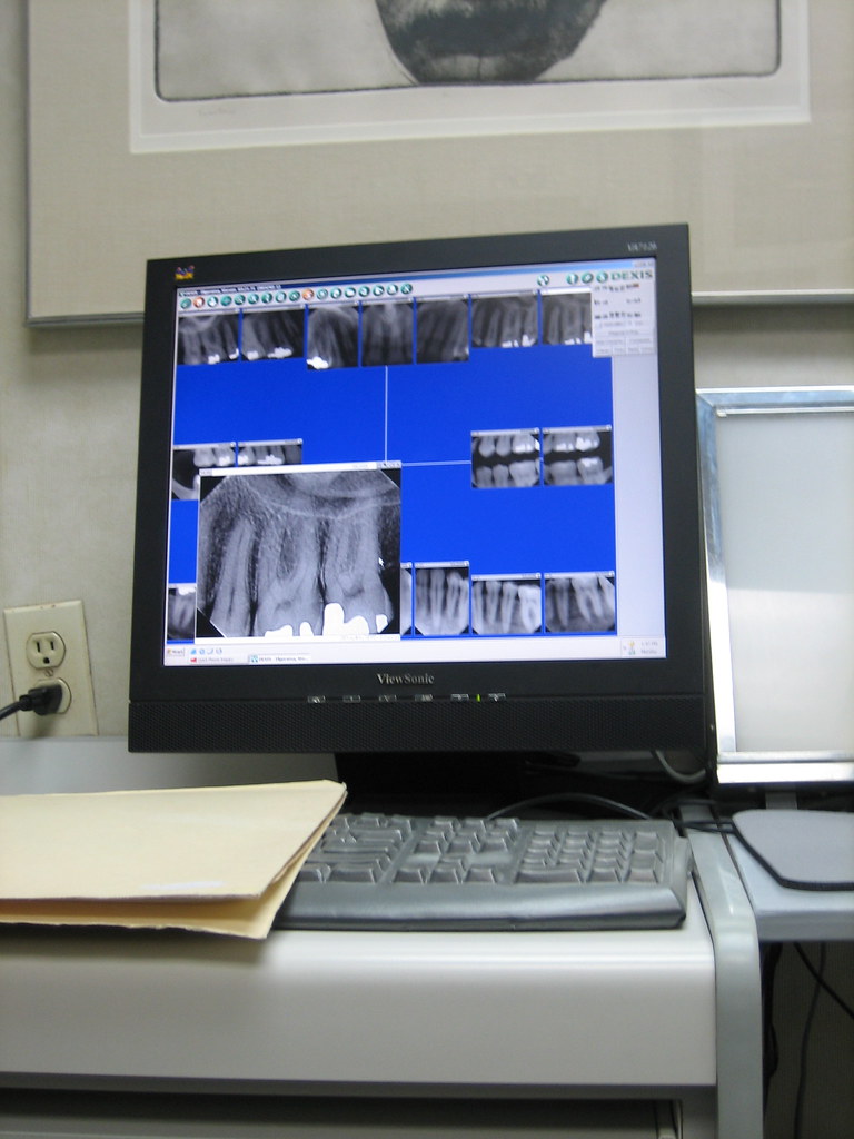 Intraoral X-Ray System