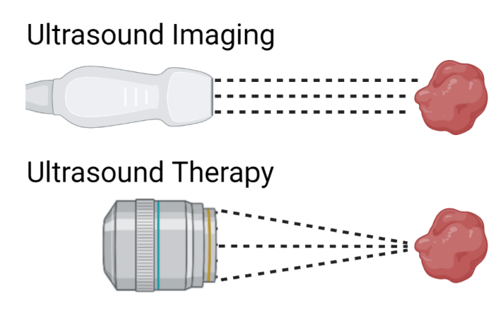 Therapeutic Ultrasound Device